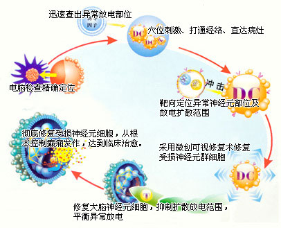 湖南癫痫病医院